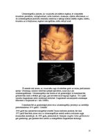 Konspekts 'Ultraskaņa', 10.