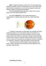 Referāts 'Tuvredzība un tālredzība', 3.