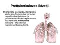 Prezentācija 'Antibiotiku izvēle grūtniecības laikā', 13.