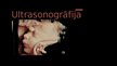 Prezentācija 'Ultrasonogrāfija', 1.