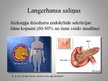 Prezentācija 'Langerhansa saliņu šūnu injekcija', 5.