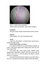 Konspekts 'Osteosarkoma, mastopātija, pūslīšmola, glomerulonefrīts un psoriāze', 4.