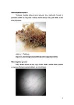 Konspekts 'Osteosarkoma, mastopātija, pūslīšmola, glomerulonefrīts un psoriāze', 8.