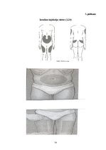 Diplomdarbs 'Cukura diabēta pacientu zināšanas par pareizu insulīna ievadi', 54.