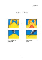 Diplomdarbs 'Cukura diabēta pacientu zināšanas par pareizu insulīna ievadi', 55.