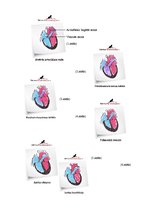 Referāts 'Zīdaiņa iedzimtās kroplības', 15.