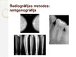 Prezentācija 'Radiogrāfija medicībā - radiācijas drošība', 8.