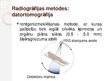 Prezentācija 'Radiogrāfija medicībā - radiācijas drošība', 14.