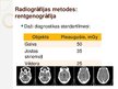Prezentācija 'Radiogrāfija medicībā - radiācijas drošība', 15.