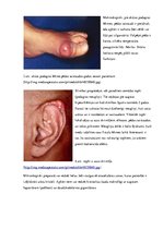 Prezentācija 'Podagras perēklis pēdas saistaudos', 5.