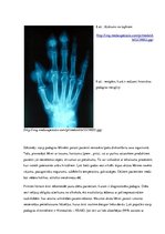 Prezentācija 'Podagras perēklis pēdas saistaudos', 8.