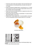 Referāts 'Mati', 19.