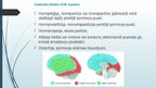 Prezentācija 'Išēmisks insults', 8.