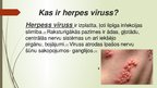 Prezentācija 'Herpes vīruss', 2.