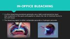 Prezentācija 'Professional Teeth Bleaching', 6.