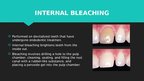 Prezentācija 'Professional Teeth Bleaching', 9.