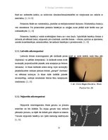Referāts 'Mikrobioloģiskais piesārņojums', 11.