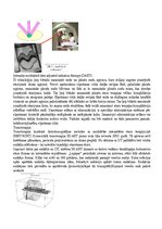 Konspekts 'Eksāmena atbildes Radiācijas terapijas tehnoloģijas', 55.