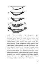 Referāts 'Ūdenstilpņu antropogēnā eitrofikācija', 16.