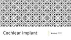 Prezentācija 'Cochlear Implant', 1.