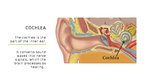 Prezentācija 'Cochlear Implant', 5.
