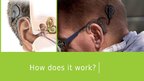 Prezentācija 'Cochlear Implant', 10.