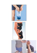 Referāts 'Fizioterapija un ārstēšanas iespējas pēc ceļa locītavas menisku traumām ', 1.