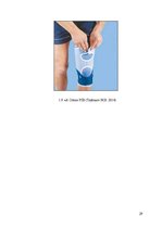 Referāts 'Fizioterapija un ārstēšanas iespējas pēc ceļa locītavas menisku traumām ', 78.