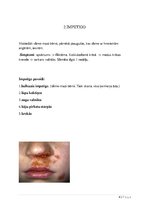 Konspekts 'Slimības, kas skar sejas ādu', 4.