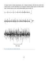 Referāts 'Elektrodiagnostika. Elektromiogrāfija', 5.
