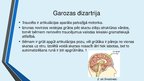Prezentācija 'Dizartrija un terapijas iespējas', 8.