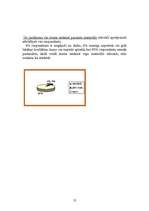 Referāts 'Stomas pacientu viedokļu analīze', 12.