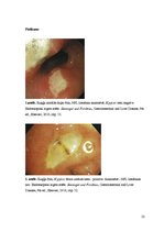 Konspekts 'Kolokvija kļūdu labojums', 22.