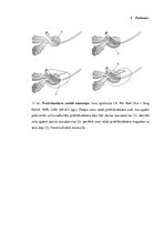 Diplomdarbs 'Skeleta scintigrāfijas izmeklējuma protokols pacientiem ar priekšdziedzera vēzi', 35.