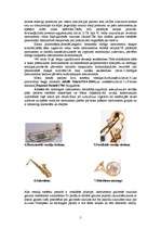 Referāts 'Metāla pūšamo instrumentu attīstība', 5.