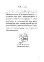 Referāts 'Starpskriemeļu diska uzbūve un iespējamās pataloģiskās izmaiņas', 9.
