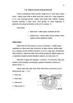 Referāts 'Vēdera priekšējās sienas trūce', 16.