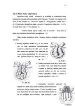 Referāts 'Vēdera priekšējās sienas trūce', 23.