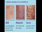 Prezentācija 'Psoriāze', 7.