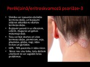 Prezentācija 'Psoriāze', 11.