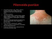 Prezentācija 'Psoriāze', 12.