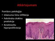 Prezentācija 'Psoriāze', 14.