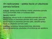Prezentācija 'Augšējās ekstremitātes skelets', 36.