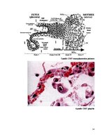 Referāts 'Citomegalovīrusa infekcija jaundzimušajiem', 14.