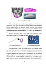 Diplomdarbs 'Kalcija fosfātu spektroskopiskie pētījumi', 26.