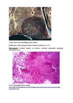 Konspekts 'Kļūdu labojums patoloģijā', 7.