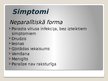 Prezentācija 'Poliomielīts', 5.