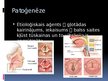 Prezentācija 'Akūti un hroniski laringīti', 4.