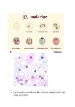 Konspekts 'Tropiskā parazitoloģija', 31.