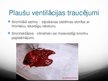 Prezentācija 'Plaušu ventilācija', 11.